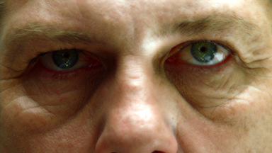 Dr. House 3x1