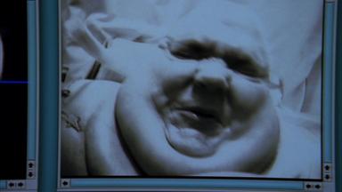 Dr. House 3x6